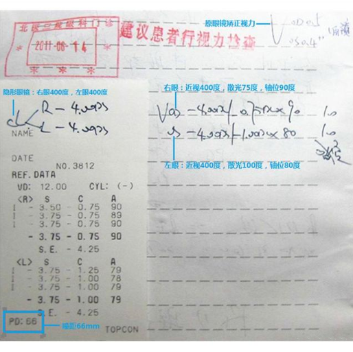 驗光單怎么看