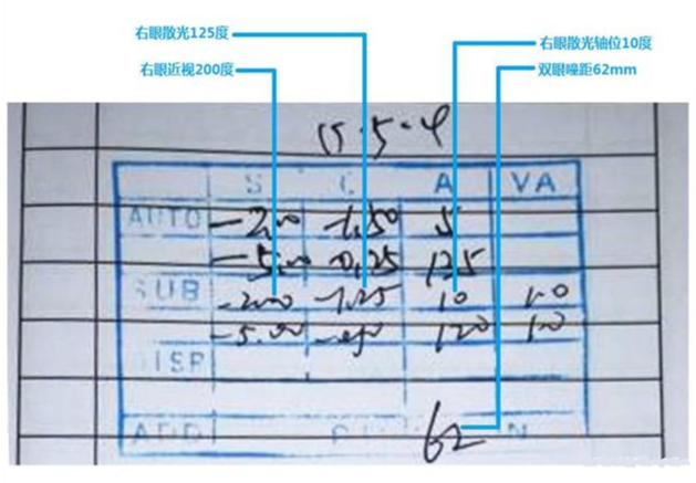 驗光單怎么看