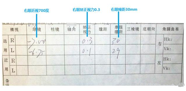 驗光單怎么看