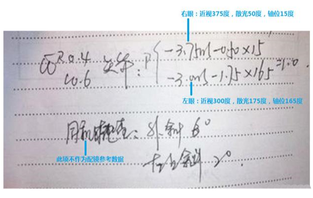驗光單怎么看