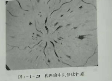 初級驗光師培訓知識點：影響視覺的原因分析