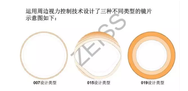 【驗光師分享】環焦、全焦和離焦這3種鏡片有什么區別？