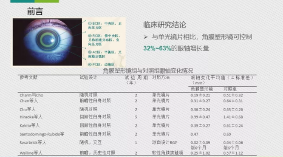 眼科醫院眼視光醫師分享角膜塑形鏡的復診流程