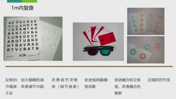 眼科醫院眼視光醫師分享角膜塑形鏡的復診流程