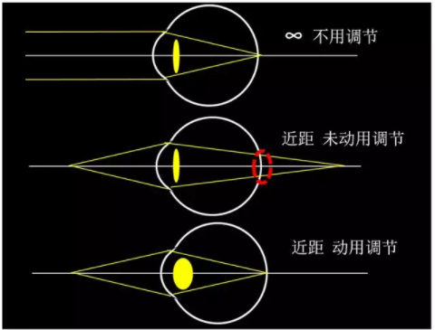 東莞驗光師培訓課程
