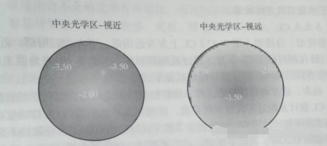 天津市眼科醫院視光中心張姝賢主任：多焦點軟性接觸鏡矯正老視的驗配要點