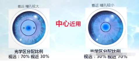 天津市眼科醫院視光中心張姝賢主任：多焦點軟性接觸鏡矯正老視的驗配要點