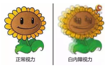 央視《健康之路》：你知道嗎？老花眼視力變好，有可能是患了白內(nèi)障