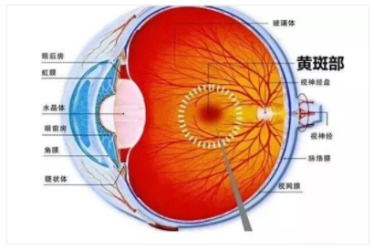 【驗光師培訓科普】一組圖告訴你的眼底還健康嗎？